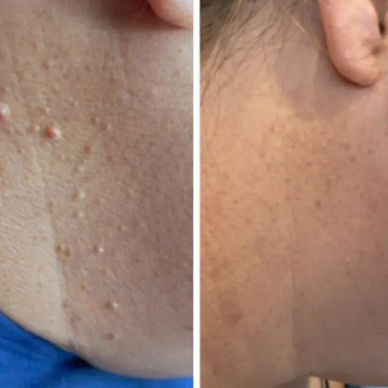 Dermolux | Addio imperfezioni della pelle.